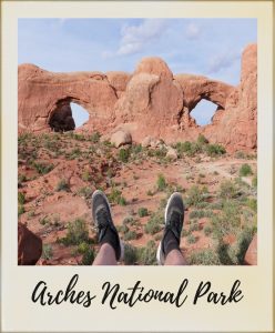 arches-pieds-l-248x300
