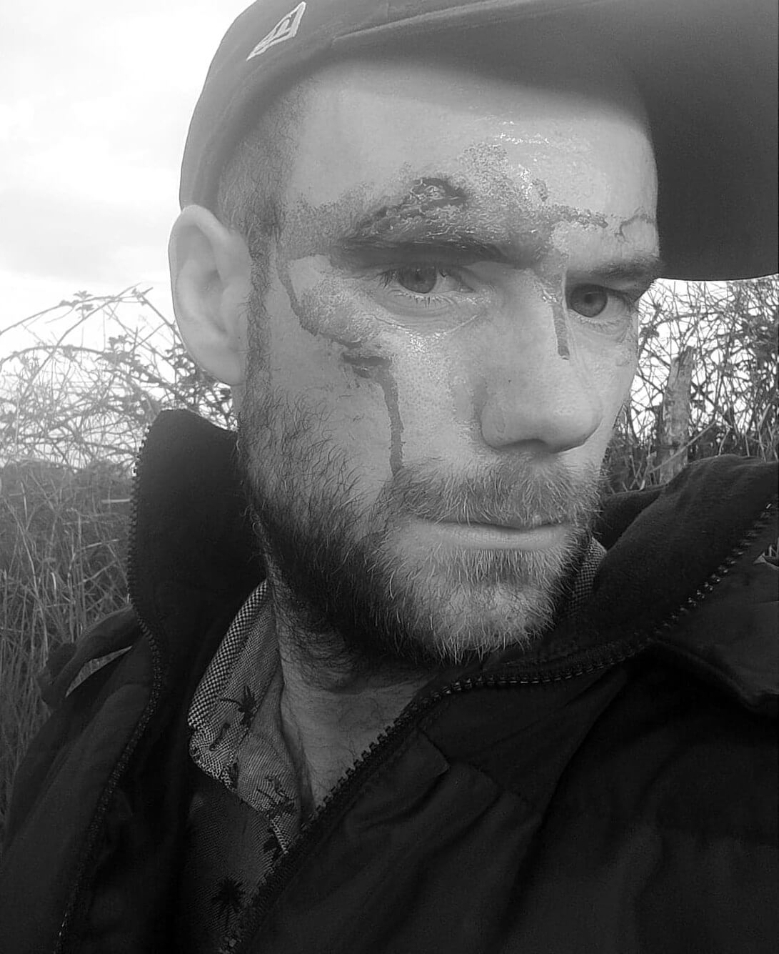 Selfie accident vélo 